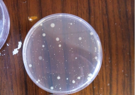 【行業(yè)干貨】從原理到實(shí)操：一文讀懂薄膜過濾法 vs 平皿法的適用邊界